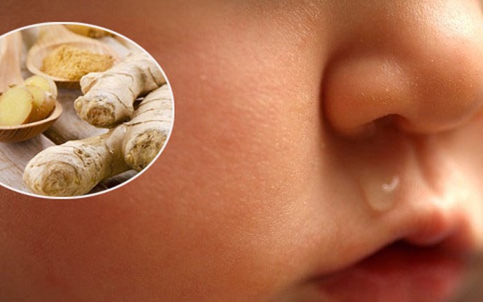 trị sổ mũi ở trẻ sơ sinh 3