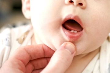 Trẻ Mọc Răng Sớm Có Sao Không? Cách Chăm Sóc Như Thế Nào?
